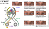 EyePupillaryReaction.png
