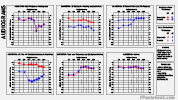 audiogram.png