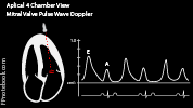 echoApical4_pulseWave_Mitral.png
