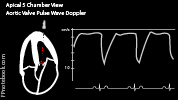 echoApical5_pulseWave_Aortic.png