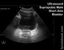 ultrasoundBMP_abdBladder_sax.jpg