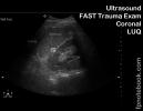 ultrasoundBMP_abdFastLUQ4.jpg