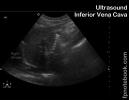 ultrasoundBMP_abdIVC_lax.jpg