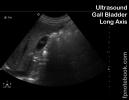 ultrasoundBMP_abdRUQgb_lax.jpg
