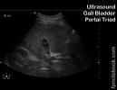 ultrasoundBMP_abdRUQgb_sax2.jpg