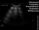 ultrasoundBMP_lungPtxEvalSliding.jpg